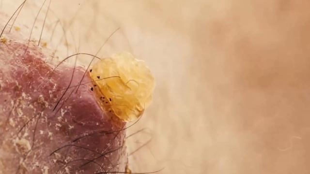 TOP 10 MOST DANGEROUS BUGS IN THE WORLD 2021 смотреть онлайн