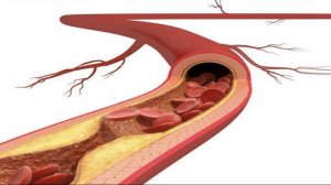 АТЕРОСКЛЕРОЗ (Оздоровление сердца и Сосудов)*Квантовое исцеление звуком