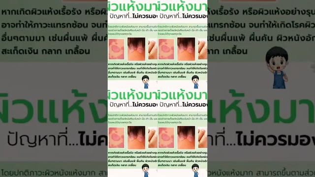 ฆ่ๅเชื้อรา 100%และรักษา สะเก็ดเงิน กลาก เกลื่อน แพ้สารเคมี แพ้เหงื่อ смотреть онлайн
