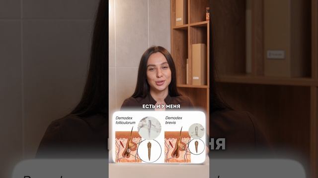 ТАК НЕ НАДО определять подкожных КЛЕЩЕЙ! #кожа #молодость #анализ