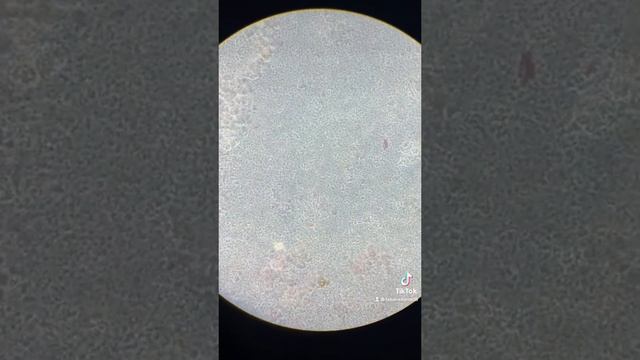 Px. Fem. 83 años. EGO. #labclinico🦠🔬 #ego #examengeneraldeorina #bacterias #leucocitos смотреть онлайн