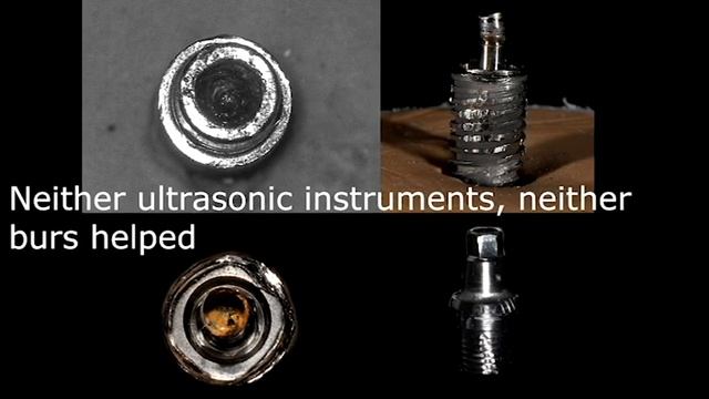 Neodent GM HELIX prosthetic parts review, breakage test:) смотреть онлайн