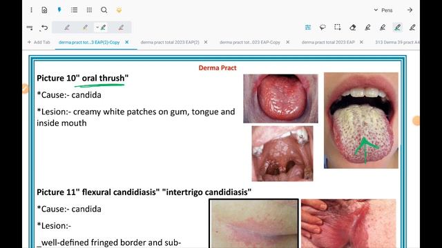 Practical - Derma - Ch 1, 2, 3, 4, 7, 10, 11, 12 - Derma & TRU смотреть онлайн