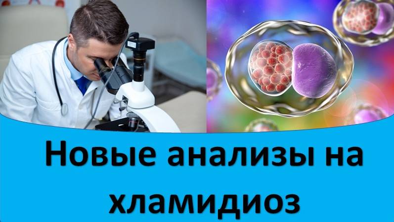 Новые анализы на хламидиоз! смотреть онлайн