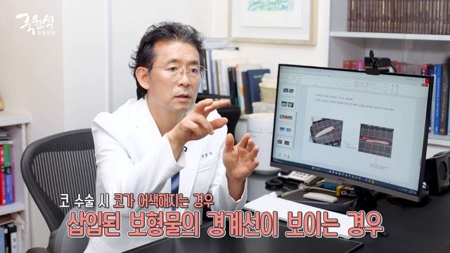 늑연골 코 성형 시 나타나는 부작용과 해결 방법은?! смотреть онлайн