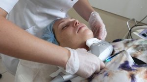 СМАС лифтинг – Ультраформер