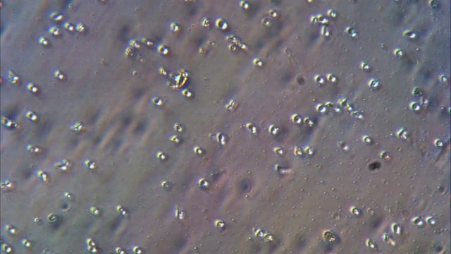 12-4 Device, cell gradient suspension, chemoattractant 200 ul.avi смотреть онлайн