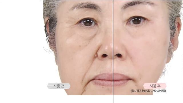 Cledbel Miracle Lifting Mask смотреть онлайн