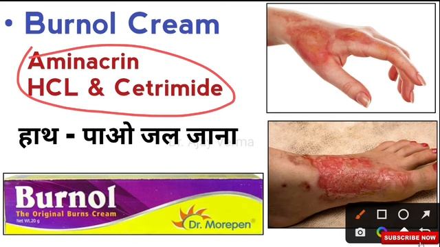 कौन सा Cream किस काम में आता है? | commonly used cream uses in hindi | Betadin | Burnol | dr. ajay смотреть онлайн