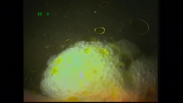 Гастроскория смотреть онлайн