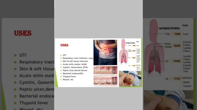 Amoxicillin capsule, Almox 500 mg , uses, side effects,dosage смотреть онлайн