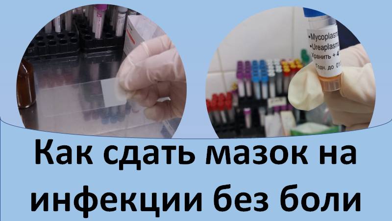 Как сдать мазок на инфекции без боли смотреть онлайн