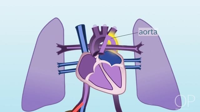 Fetal Circulation by L. McCabe | OPENPediatrics смотреть онлайн