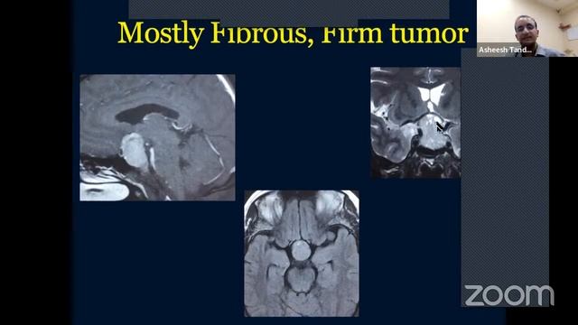 Minimally Invasive Brain/Spine Forum: March 11, 2022 смотреть онлайн