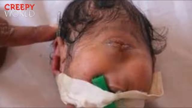 Expecting Mother Left Heartbroken After Giving Birth To A Cyclops Baby Who Dies Within Seconds смотреть онлайн