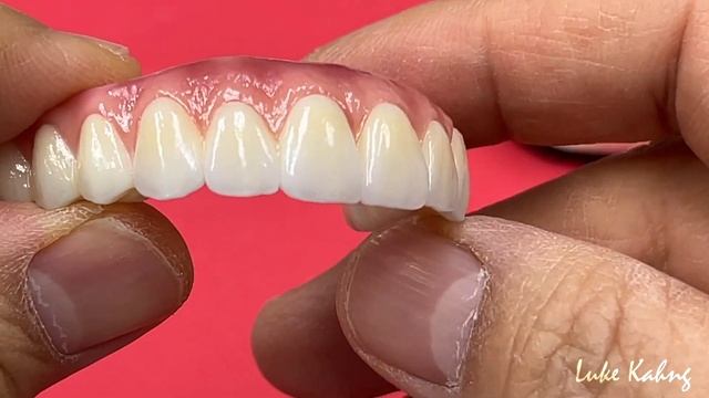 Exciting Techniques for All-On-4 Zirconia Insertions смотреть онлайн