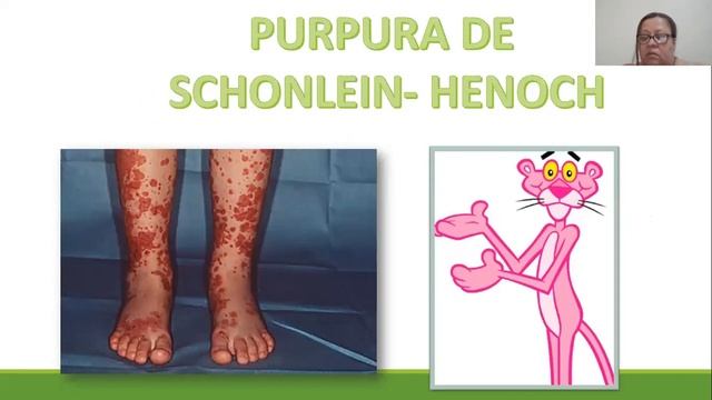 FIN DE CICLO VASCULITIS 1 -09- 2020 смотреть онлайн