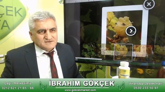 Sedef Hastalığının Tedavisi, Böbrek Yetmezliğinin Tedavisi, Saçkıran Tedavisi Nasıl Yapılır,