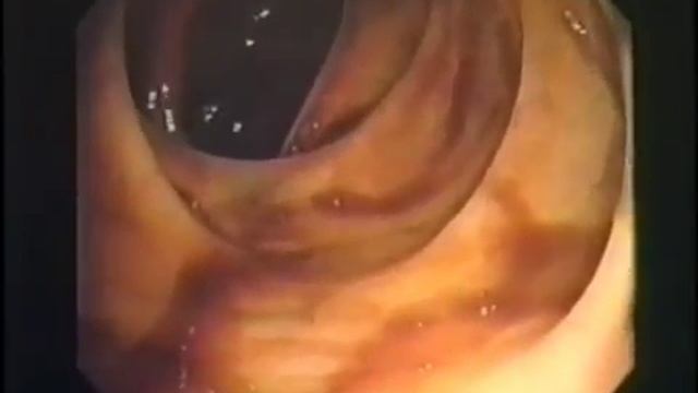 Пробиотический ферментный экстракт. Результаты смотреть онлайн