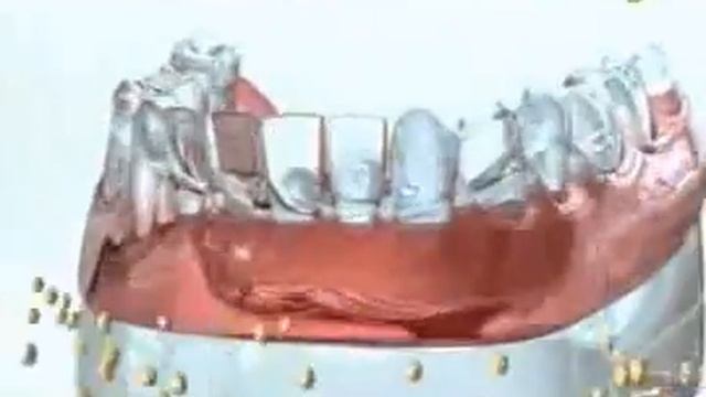 Adhésives Protefix La solution idéale des problèmes d’adhésion 27 03 2011 смотреть онлайн