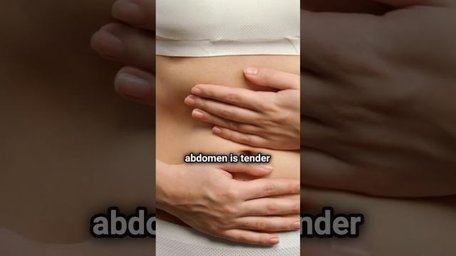 What is IBS? смотреть онлайн