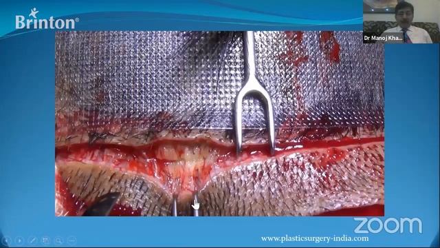 Androgenetic Alopecia an Integrated Treatment Approach смотреть онлайн