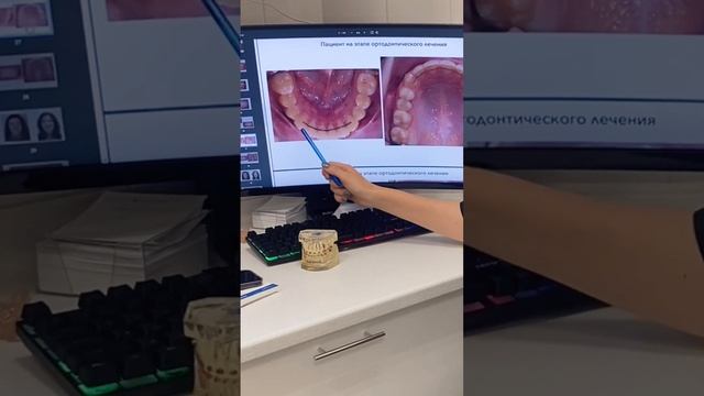 ретейнеры смотреть онлайн