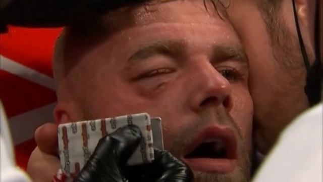 Canelo Alvarez BUSTS Billy Joe Saunders CHEEKS until he QUITS! (CANELO vs SAUNDERS FIGHT REACTION) смотреть онлайн