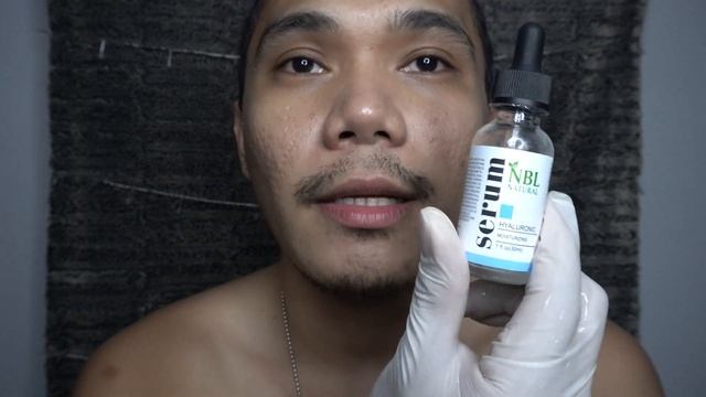 DIY MICRONEEDLING FOR ACNE SCARS | Session 3 смотреть онлайн