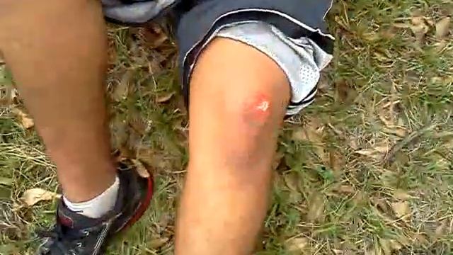 Down hill scooter fail- CKY jr смотреть онлайн