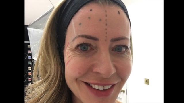 'Botox creams' v Botox: the half-face test смотреть онлайн