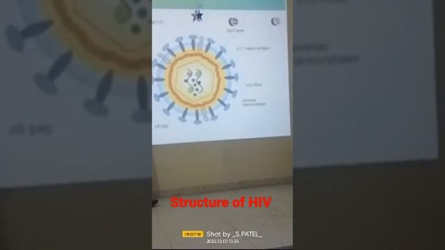 AIDS day #structure of HIV #1december #aisdproud #hiv смотреть онлайн