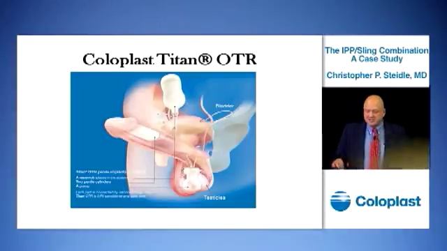 The IPP/Sling Combination -- A Case Study -- Christopher Steidle, MD смотреть онлайн