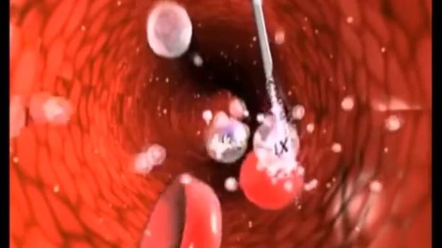 Health Focus: The Agony Of Living With Haemophilia