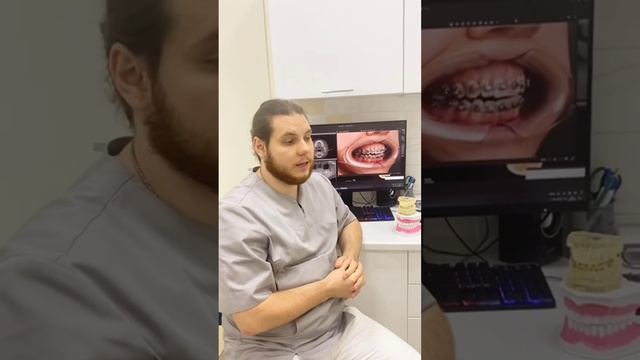 вопрос гнатологу смотреть онлайн