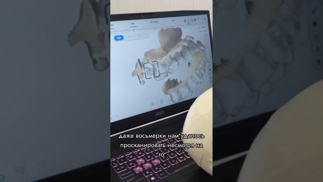 Как проходит сканирование #стоматология #виниры #стоматологортопед #винирымосква #имплантациязубов смотреть онлайн