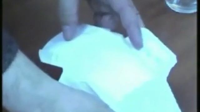 В.Иняткин. Анионовые прокладки, презентация 2010 г смотреть онлайн