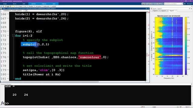 Essentials of Neuroscience with MATLAB: Module 2-5 (EEG) смотреть онлайн