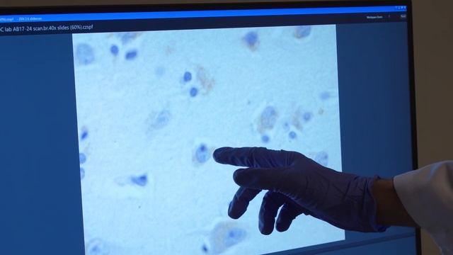 Machine Learning Enhances Dementia Research - Cultivating Health смотреть онлайн