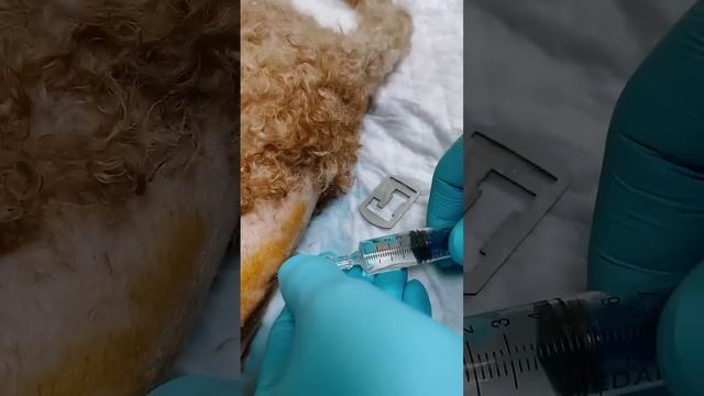 Миелография 💉 смотреть онлайн