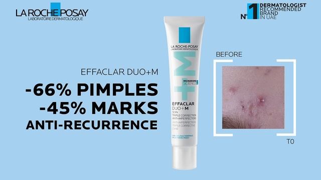 NEW Effaclar Duo+M смотреть онлайн