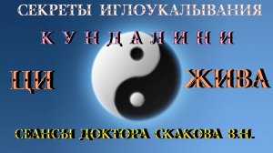 СЕАНСЫ Доктора Скакова В.Н.. Секреты иглоукалывания.