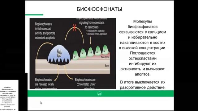Лекция ОНКОР 28 08 2019 Подходы к лечению костных метастазов смотреть онлайн
