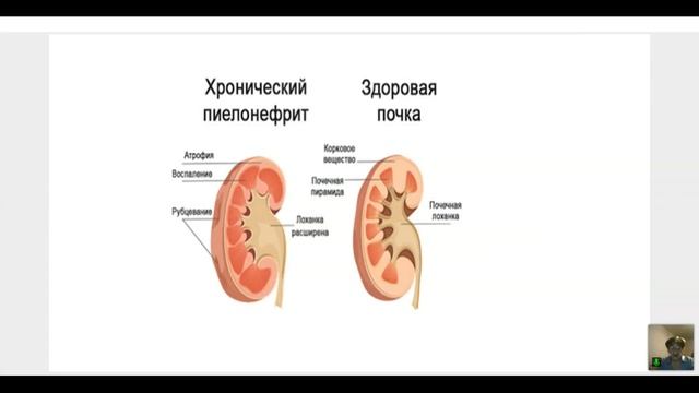 Вечернее занятие 30 марта 2021. Галина Томина смотреть онлайн