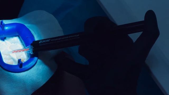 Отбеливание зубов в Самаре. Система Zoom 4. Услуги стоматолога - клиника White Dental Clinic Самара смотреть онлайн