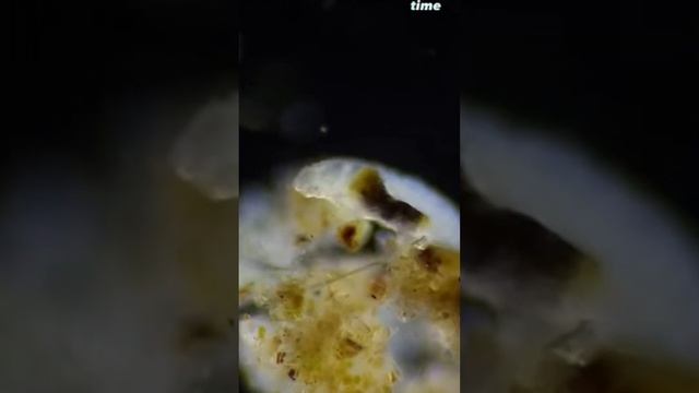 moss under microscope waterbear bactaria смотреть онлайн