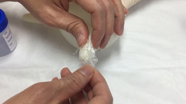 Circumcision Preparation - apply numbing anaesthestic cream before surgery смотреть онлайн