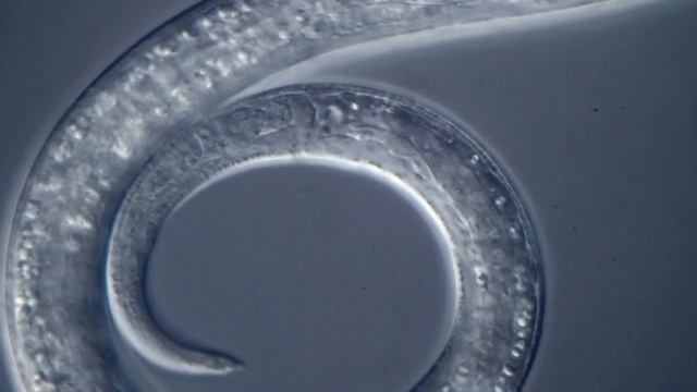 Spiral Nematode смотреть онлайн