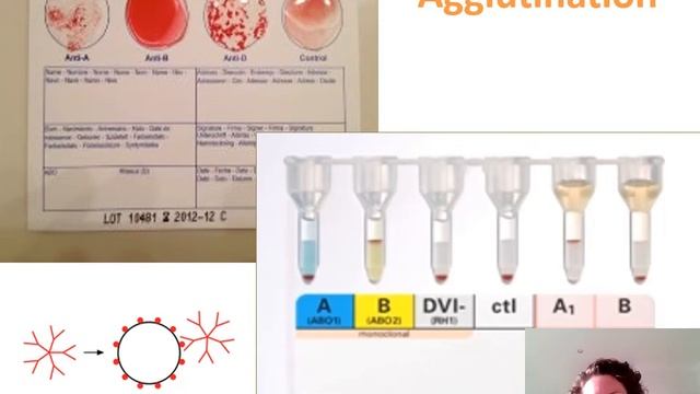 Transfusion Medicine - Introduction for medical students смотреть онлайн