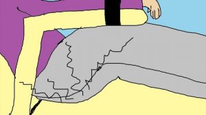 Обосрался у зубного